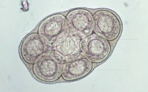 Naujas parazitologų radinys – Dipylidium caninum – kaspinuočio kiaušinėlių kapsulės